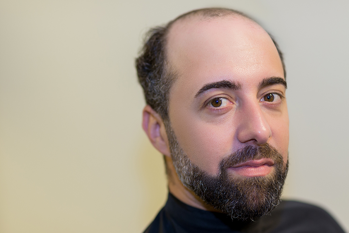 Cuáles son los tipos de alopecia