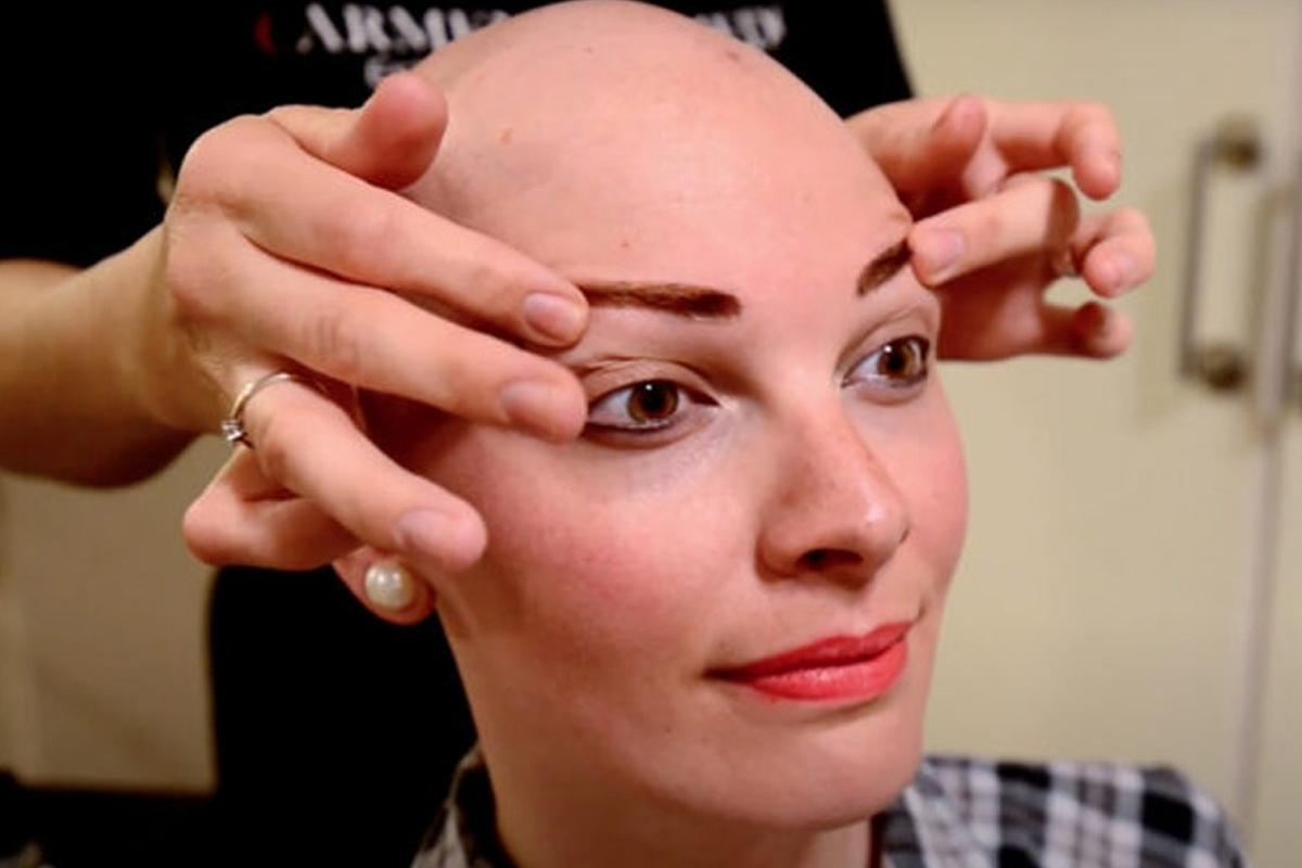 Cómo cubrir todo tipo de alopecia